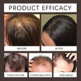 thumbnail image 4 of Hairline Powder Hair Root Dye for Women, Hair Shadow Powder Root Touch Up Powder, Waterproof Hair Shading Sponge Brown,Quick Root Cover Up, Hair Fibers for Thinning Hair, 4 of 7