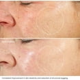 thumbnail image 2 of KLEEM ORGANICS Hydratant au Rétinol - Crème Anti-Rides pour Réduire les Rides, Taches Brunes et Dommages Causés par le Soleil - Idéal pour le Visage, le Cou et le Décolleté avec 2,5 % de Rétinol et Acide Hyaluronique - Meilleurs Résultats en 6 Semaines, 2 of 7
