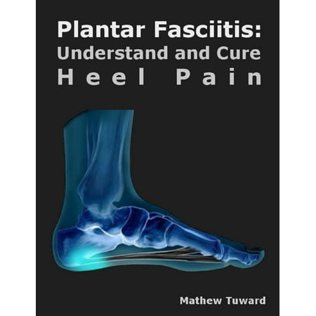 Plantar Fasciitis: Understand and Cure Heel Pain - (Best Cure For Plantar Fasciitis)