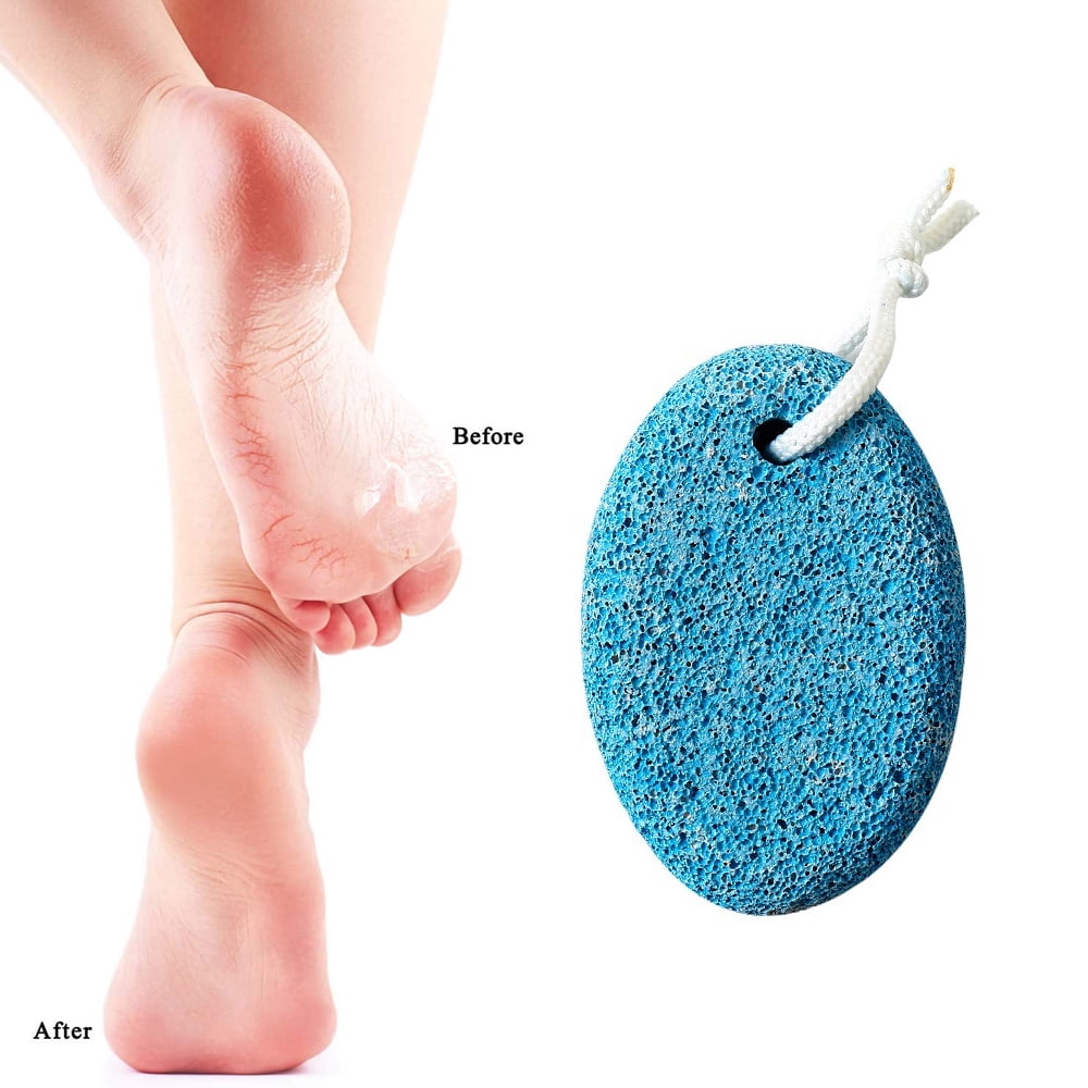 Natural Foot Pumice Stone for Feet, 2-Pack Lava Pedicure Tools Hard Skin Callus Remover for Feet and Hands-quantity:10 pieces;