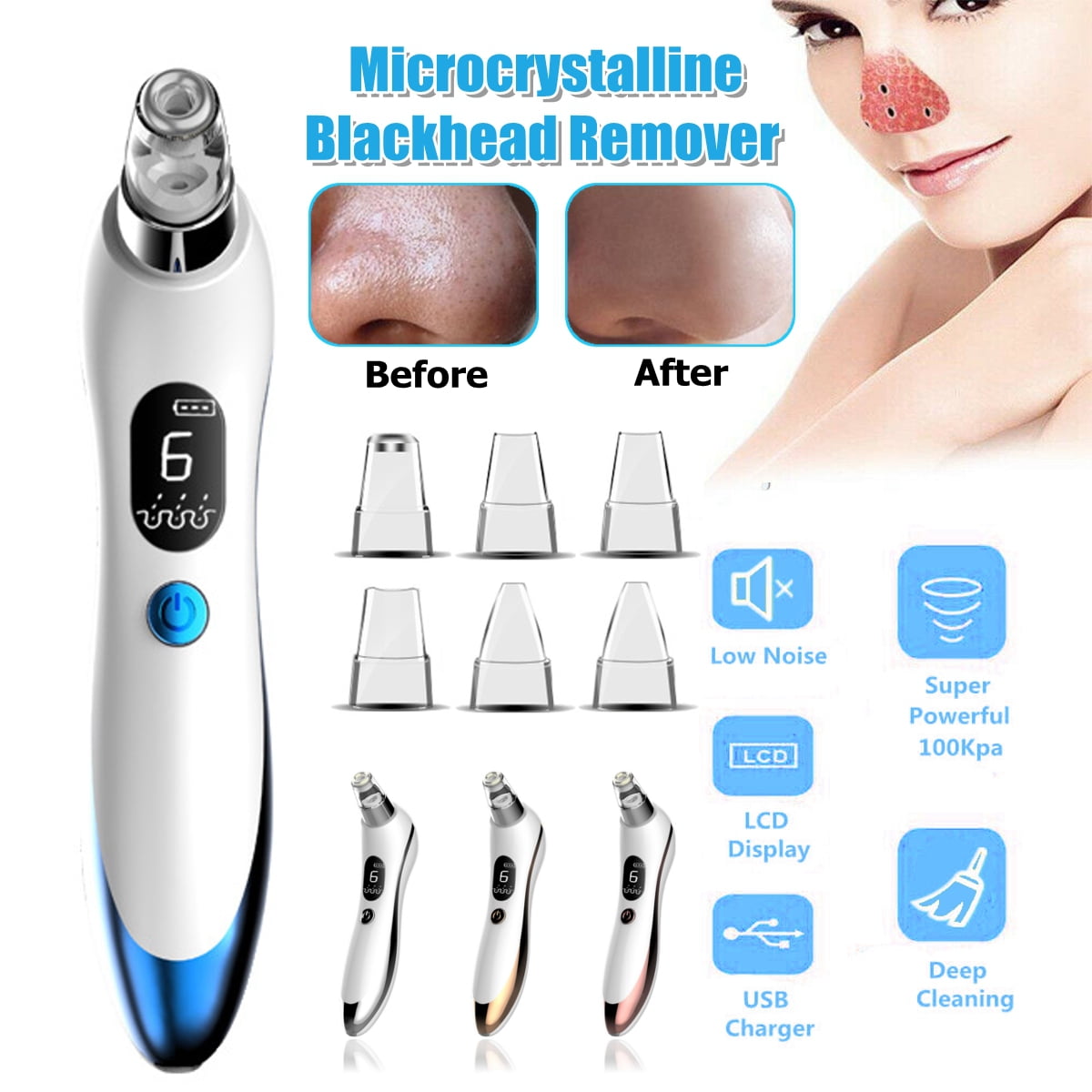Blackhead Remover Facial Pore Cleaner Vacuum Suction Facial Blackhead