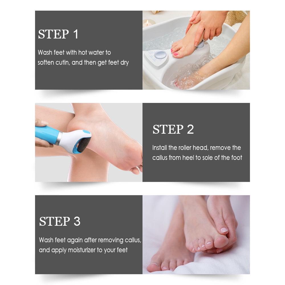 Amerteer Electric Callus Skin Remover Massager Smoother Foot Heel Cuticle Pedicure Foot Scrubber Grinder Suitable for Dry and Cracked Skin, White