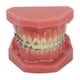 thumbnail image 1 of Modelo de demostración de ortodoncia dental Modelo de dientes con alambres de metal y soporte para enseñanza y aprendizaje, 1 of 15