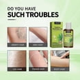 thumbnail image 4 of Cyperus oil Rotundus for hair removal - 100% natural Cyperus oil reducing the growth of body hair, moisturizing and soothing 50ml, 4 of 5