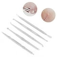 thumbnail image 5 of 5pcs Stainless Steel Pimples Acne Blackheads Extractor Tweezers Needles Tool Kit, 5 of 8