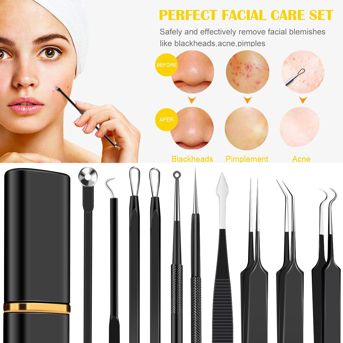 Toorise 10pcs Pimple Popper Tool Kit Stainless Steel Blackhead Remover Tool  Comedones Extractor for Forehead Facial Nose Lightweight Acne Needle Tool  with Metal Case for Travel Home Use 