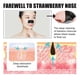 thumbnail image 4 of West & Month Blackhead Stickers 10PCS, 4 of 4