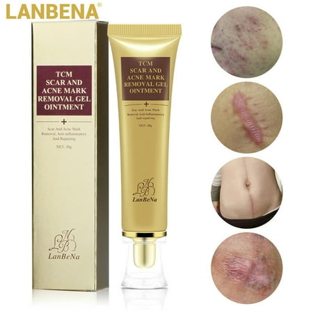 LANBENA Pimple Scar Acne Mark Spots Removal Treatment Gel Ointment Blemish Cream 1 (Best Pimple Ointment India)