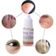 thumbnail image 1 of 1 botella de bacteriostático eliminador de marcas en la piel 12 Ndcxsfigh horas de cuidado de lunares (etiqueta en la piel), 1 of 8