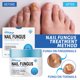 thumbnail image 1 of Teissuly Nail Repair Cream For Repairing Gray Nails, Brightening And Thickening Nails, Hand And Foot Nails, Moisturizing And Caring Cream Teissuly WER202401271577, 1 of 9