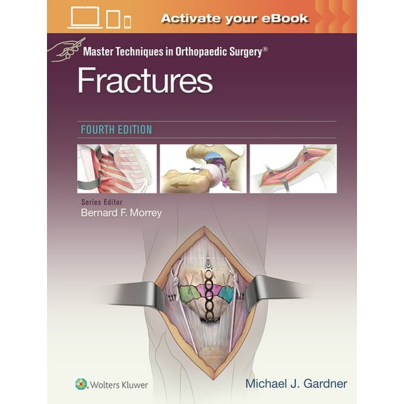 Master Techniques in Orthopaedic Surgery Master Techniques in Orthopaedic Surgery: Fractures, (Hardcover)