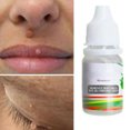 thumbnail image 3 of Eliminador De Lunares, 10Ml, Eliminación De Verrugas, Líquido Altamente Eficiente, Cara Suave, Seguro Para La Piel, Eliminador De Verrugas, Etiqueta De Piel Efectiva De Corto Tiempo Serendint CE004266-00, 3 of 6