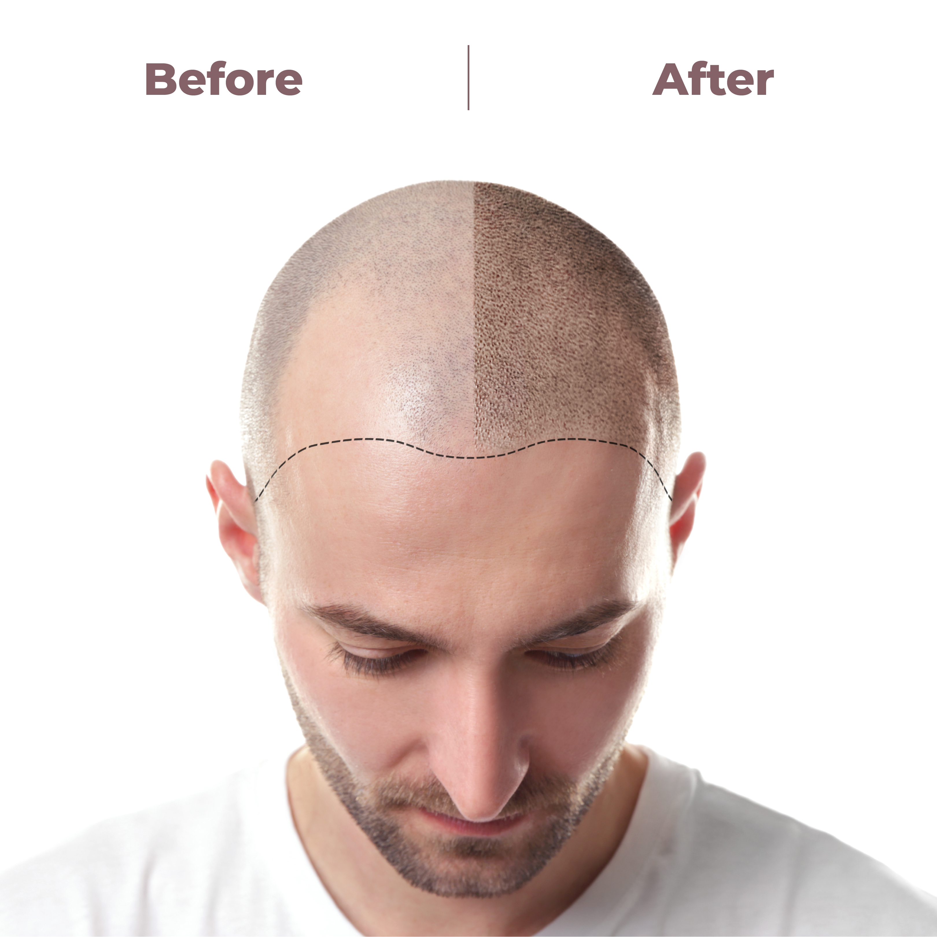 Buy ReGrow Hair Activation Formula Hair Growth Vitamins with Biotin