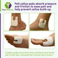 thumbnail image 6 of U Shaped Felt Callus Pads - Adhesive Foot Pads That Protect Calluses from Rubbing On Shoes - 3/16" - 100 Pack, 6 of 8