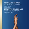 thumbnail image 3 of Vaseline Intensive Care Problem Skin Therapy Body Cream, 3 of 8