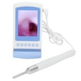 Professional Ear Cleaning Endoscope High‑Definition Visual Otoscope US