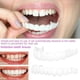 thumbnail image 3 of Smile Dental False Teeth Cover Perfect Smile Veneers Comcompatiblet Fit Flex Denture Teeth, 3 of 4