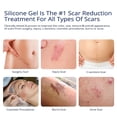 thumbnail image 3 of MURASAKI BEAUTY Silicone Scar Gel for C-Section, Stretch Marks, Acne, Surgery, Effective for both Old and New Scars, 3 of 5