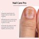 thumbnail image 4 of Ultragrow Nail Serum, Nail Growth & Strengthening, Nail Support for Growth and Resistance for Thin Brittle Nails from Fragile Peeling, 4 of 5