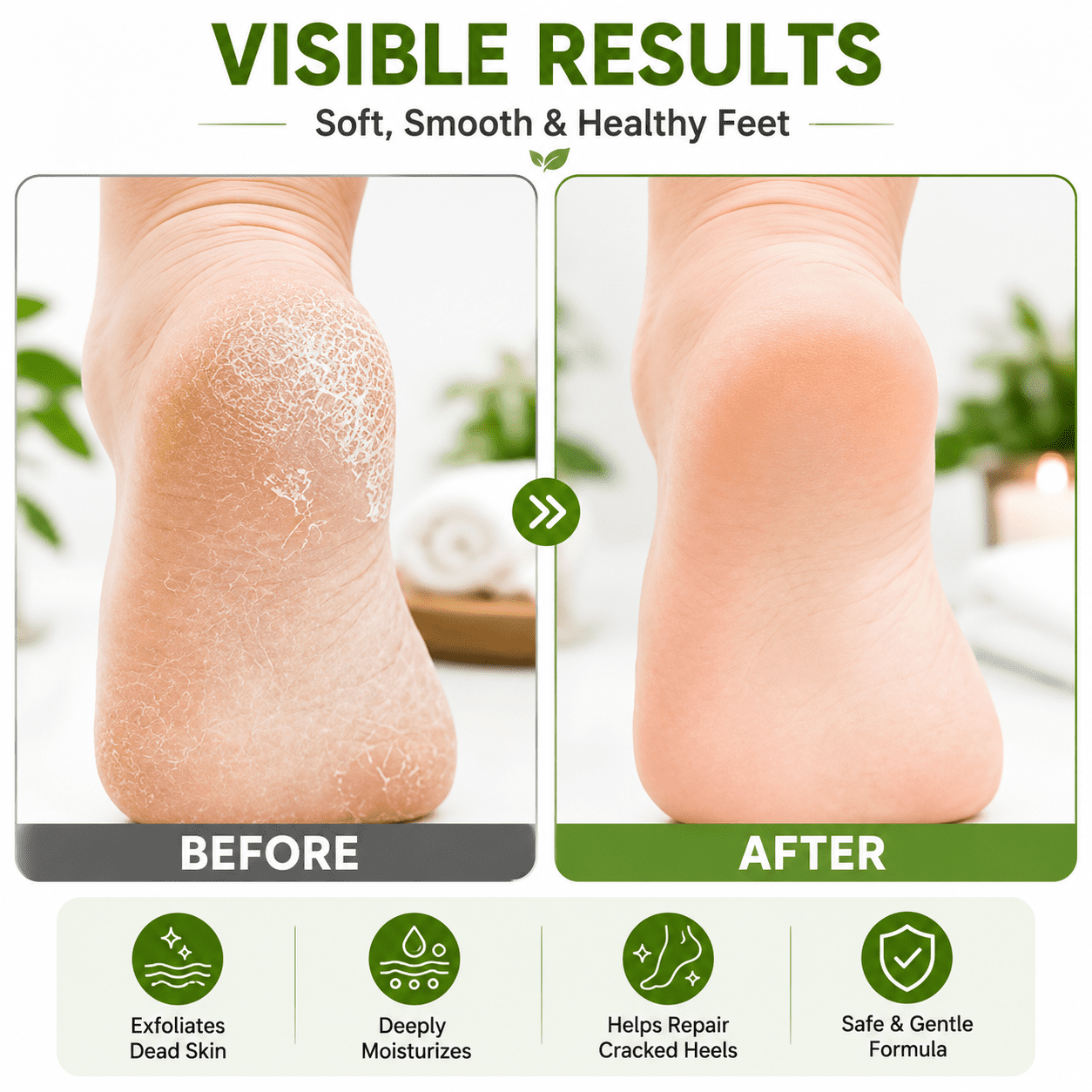 Tori Mika Mini Pumice Stone for Feet 400 PCS, Disposable Callus Remover Bulk Pack, Foot Scrubber for Dead Skin & Rough Heels, Professional Pedicure Tools for Salon Spa, Foot Exfoliator, Corn Remove