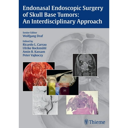 UPC: 9783131546715 | Endonasal Endoscopic Surgery of Skull Base Tumors: An Interdisciplinary Approach (Hardcover)