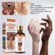 thumbnail image 2 of 2-Pack Knuckle Whitening Serum Skin Glow Fading Acne Dark Spot Correcting Facial Whitening Serum, 2 of 5