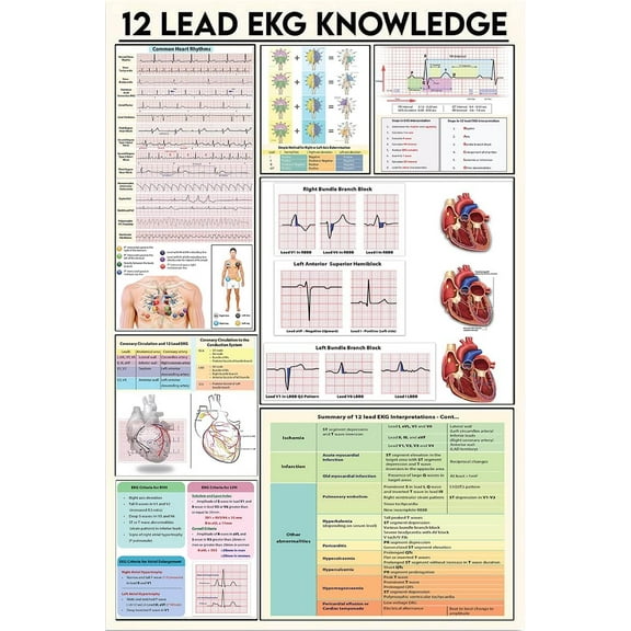 8 x 12 in Metal Tin Sign - 12 LEAD EKG KNOWLEDGE Metal Tin Sign Retro Style Artwork Infographic Analysis For Club Home Office Classroom Living Room Guide Reference Chart Wall Decor