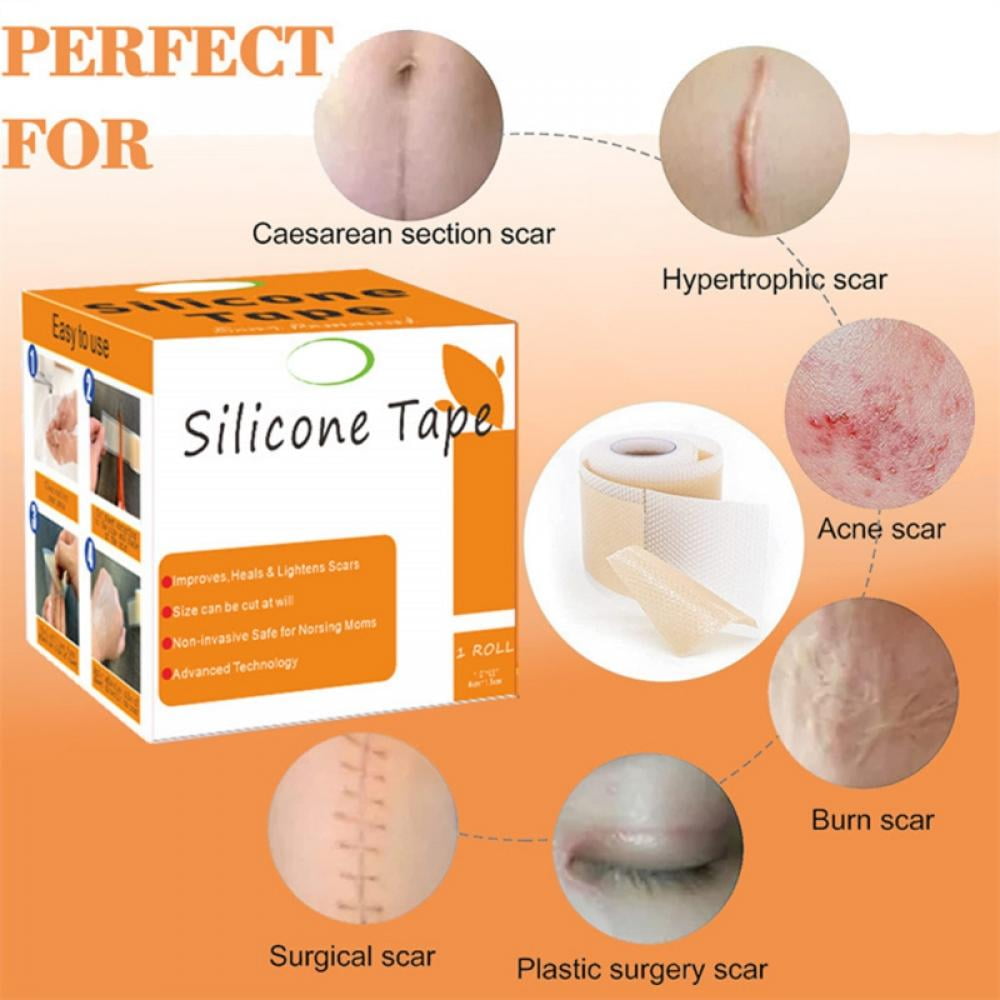 Silicone Scar Sheets (1.86” x 157” Roll-4M), Silicone Scar Tape Roll,  Reusable, for C-Section, Surgery, Burn, Keloid, Acne et 3 Pack