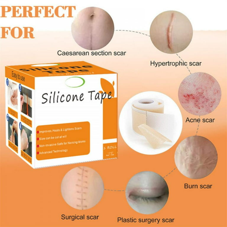 Medical Silicone Tape,Silicone Roll ,Silicone Roll for old and new scar  treatment - My WordPress Website