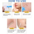thumbnail image 4 of 100pcs Blackhead Blemish Remover, Acne Pimple Popper Needle, Pimple Needles, Blackhead Remover Set For Clear Skin, 4 of 8