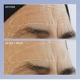 thumbnail image 2 of Sérum Perricone MD de alta potencia con triple renovación de retinol, 60 ml, 2 of 3