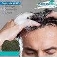 thumbnail image 2 of Jabón Para Psoriasis y Dermatitis, Dermabon 3 pzas Dermabon 2003, 2 of 4