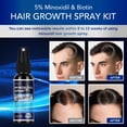 thumbnail image 3 of Minoxidil Spray IRISTAR 5% para la regeneración del cabello para hombres y mujeres, 3 of 8