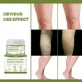 thumbnail image 3 of Safflower Relieve Pain Bulging Legs Red Blood Streak Varicose Vein Cream Leg Care Cream Leg Swelling Earthworm, 3 of 6