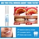 thumbnail image 4 of Lápiz blanqueador dental rotatorio, 4 ml., 4 of 4