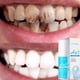 thumbnail image 3 of Ganfancp Ha5 Hyaluronic Serum Hialurónico para La Salud Favorece La Hidratación Favorece La Producción de Saliva Favorece La Salud y Los Tejidos Blandos Ofertas de La Semana 1X Pasta Dentífrica, 3 of 7