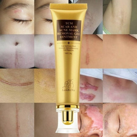 2 packs Scar Acne Mark Removal Gel Face Pore Skin Repair Stretch Marks Cream Blemish