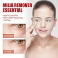 thumbnail image 3 of Milia Remover Essential Eye Serum Effective Removes Fat Granules Eye Bags Anti-particles Puffiness, 3 of 6