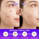 thumbnail image 4 of Pegatinas CELECARE para acné Pimple Patches con ácido salicílico, 120 unidades, 4 of 6