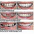 thumbnail image 2 of Smile Snap On False Teeth Upper Lower Dental Veneers Dentures Tooth Cover Set _fs, 2 of 5