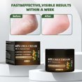 thumbnail image 4 of Crema para pies WillCome Urea 60% con 2% de ácido salicílico 150 ml, 4 of 7