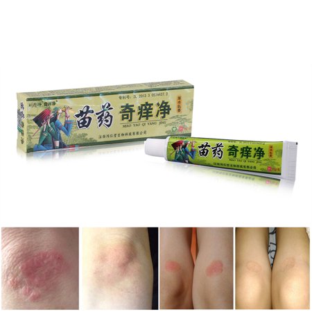 FAGINEY Miao Medicine Herbal Antibacterial Skin Itch Psoriasis Allergy Dermatitis Eczema Cream Chinese , Herbal Ointment, Itch (Best Anti Itch Medicine)