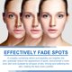 thumbnail image 5 of Fiudx Crema para Manchas Oscuras, Loción Iluminada Retinol y Vitamina C, Corrector Facial Corporal Suave y Reparador, Pigmentación, Melasma y Manchas de La Edad, Cuidado Diario para Mujeres, Tamaño P, 5 of 7
