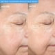 thumbnail image 5 of Cepillo de limpieza facial PMD Beauty Smart Silicone con luz azul, 5 of 9