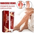thumbnail image 4 of Crema para aliviar el dolor de piernas de 20g ungüento eficaz para el tratamiento de las venas varicosas a base de hierbas uso externo de la piel ungüento para la fatiga cuidado de la salud, 4 of 9
