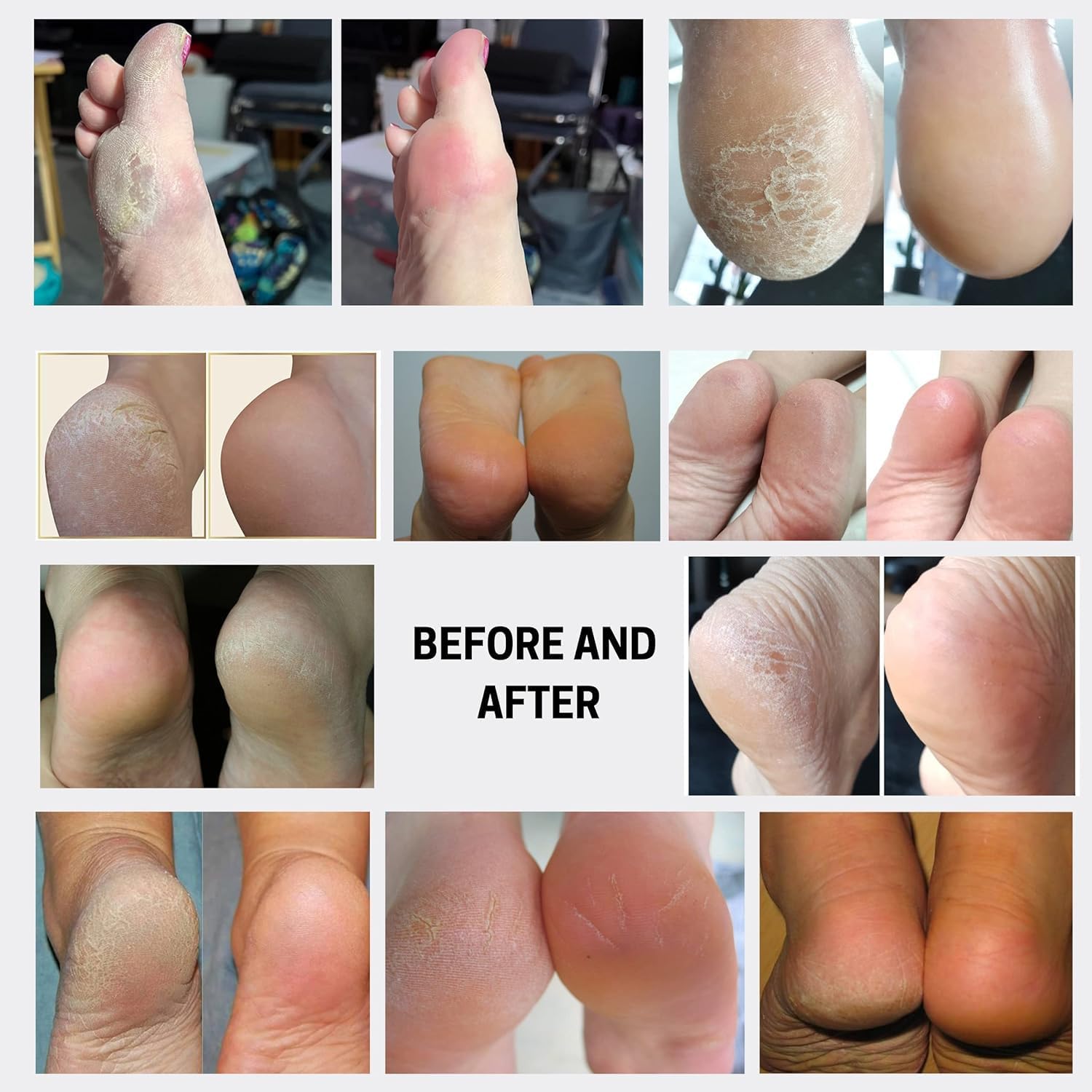 Wonder Pedi Instant Soft Foot Callus Remover Feet Softener Spray Professional Spa Quality