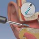 thumbnail image 3 of Limpiador de cera de los oídos, endoscopio Visual inteligente de alta deFinición de 3,6mm y 1000W para limpieza de Canal auditivo, elimina la cera de los oídos, cuidado de la salud, 3 of 3