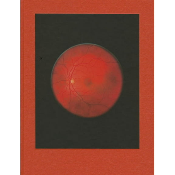 Michael Subotzky: Retinal Shift, (Hardcover)