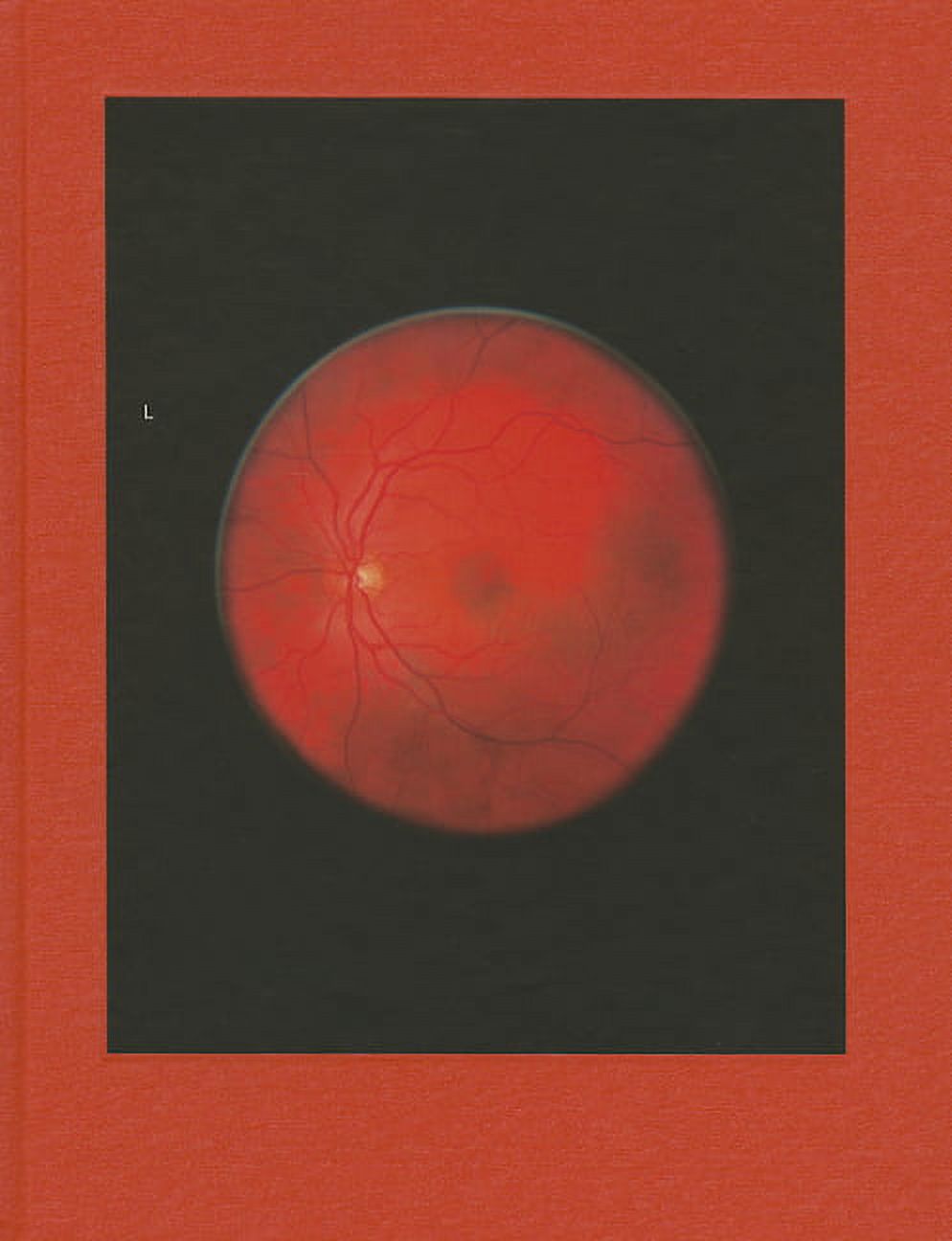 Michael Subotzky: Retinal Shift, (Hardcover)