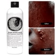 thumbnail image 3 of Acne, Eczema, Psoriasis, Face, Body, Dark Spot Remover - Men Women  Natural Black Soap with Aloe  - This Soap Works, 3 of 8